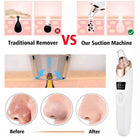 5in1 Blackhead Remover Machine Rechargeable | Face Vacuum Derma Suction With 5 Heads | Blackhead Removing Machine